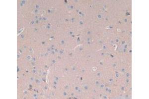 Figure. (SYN1 antibody  (AA 113-420))