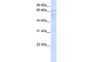 WB Suggested Anti-OPTN Antibody Titration:  0. (OPTN antibody  (N-Term))