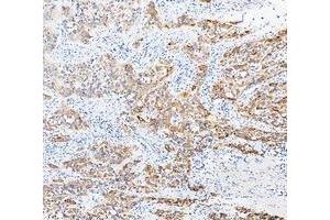 IHC analysis of Cytokeratin 20/Krt20 using anti-Cytokeratin 20/Krt20 antibody (ABIN7601133). (KRT20 antibody  (AA 29-431))