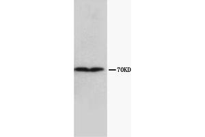 Western Blotting (WB) image for anti-Collagen, Type III, alpha 1 (COL3A1) (Chain alpha 1) antibody (ABIN1106750) (COL3A1 antibody  (Chain alpha 1))