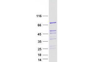 RAB11FIP5 Protein (Myc-DYKDDDDK Tag)