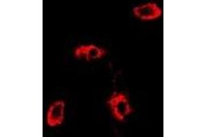 Immunofluorescent analysis of RAB11A staining in MCF7 cells. (RAB11A antibody)