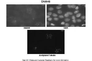Immunohistochemistry (IHC) image for anti-Dynein, Axonemal, Heavy Chain 9 (DNAH9) (C-Term) antibody (ABIN970528) (DNAH9 antibody  (C-Term))