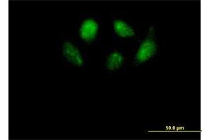 Immunofluorescence of purified MaxPab antibody to SMU1 on HeLa cell. (SMU1 antibody  (AA 1-513))