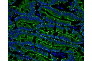 human duodenum (courtesy of L. (Cytokeratin 19 antibody)