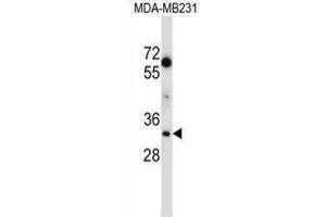 Western Blotting (WB) image for anti-Lactate Dehydrogenase A (LDHA) antibody (ABIN2997387)