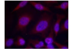 Image no. 1 for anti-Mitogen-Activated Protein Kinase 8 (MAPK8) (pThr183), (pTyr185) antibody (ABIN401562) (JNK antibody  (pThr183, pTyr185))