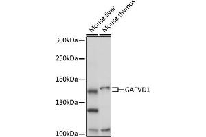 Western blot analysis of extracts of various cell lines, using G antibody (ABIN7267529) at 1:1000 dilution. (GAPVD1 antibody  (AA 1-260))