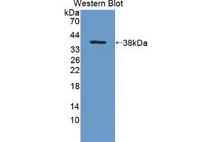 Figure. (PTPRG antibody  (AA 848-1119))