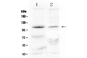 Western blot analysis of HIF2A using anti- HIF2A antibody . (EPAS1 antibody  (Middle Region))