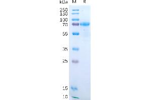 Human IL15RA Protein, hFc Tag on SDS-PAGE under reducing condition. (IL15RA Protein (AA 31-205) (Fc Tag))