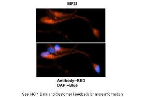 Sample Type: Mouse brain stem cells Primary Antibody Dilution: 1:500Secondary Antibody: Goat anti-rabbit Alexa-Fluor 594 Secondary Antibody Dilution: 1:0000Color/Signal Descriptions: EIF3I: Red DAPI: Blue  Gene Name: EIF3I Submitted by: Dr. (EIF3I antibody  (C-Term))