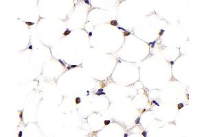 Immunohistochemistry analysis of paraffin-embedded mouse adipose tissue using PPARG Monoclonal Antibody at dilution of 1:1000. (PPARG antibody)