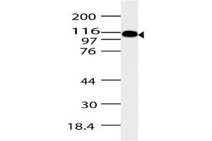Image no. 1 for anti-ArfGAP with SH3 Domain, Ankyrin Repeat and PH Domain 2 (ASAP2) (AA 500-760) antibody (ABIN5027043)
