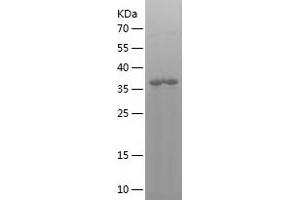 Western Blotting (WB) image for Interleukin 8 (IL8) (AA 26-167) protein (His-IF2DI Tag) (ABIN7123621) (IL-8 Protein (AA 26-167) (His-IF2DI Tag))