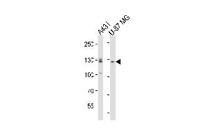 Western blot analysis of lysates from A431, U-87 MG cell line (from left to right), using EPHA2 Antibody (Center) (ABIN6243644 and ABIN6577706). (EPH Receptor A2 antibody  (AA 518-552))