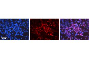 Rabbit Anti-GABPA Antibody Catalog Number: ARP31186_P050 Formalin Fixed Paraffin Embedded Tissue: Human Lymph Node Tissue Observed Staining: Nucleus Primary Antibody Concentration: 1:100 Other Working Concentrations: 1:600 Secondary Antibody: Donkey anti-Rabbit-Cy3 Secondary Antibody Concentration: 1:200 Magnification: 20X Exposure Time: 0. (GABPA antibody  (N-Term))