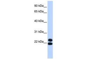 Image no. 1 for anti-Paired Related Homeobox 2 (PRRX2) (AA 35-84) antibody (ABIN6742837)