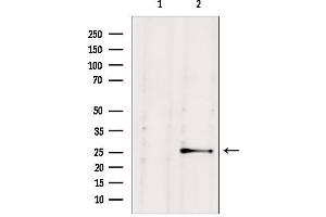 Western blot analysis of extracts from HepG2, using NUDT21 antibody. (NUDT21 antibody  (Internal Region))