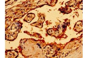 Immunohistochemistry of paraffin-embedded human placenta tissue using ABIN7161270 at dilution of 1:100 (Neurofibromin 1 antibody  (AA 655-892))
