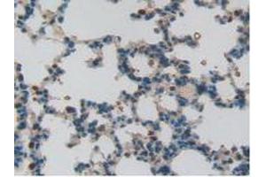 Immunohistochemistry (IHC) image for anti-S100 Calcium Binding Protein A11 (S100A11) (AA 9-98) antibody (ABIN7432082)