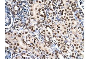 RSU1 antibody was used for immunohistochemistry at a concentration of 4-8 ug/ml. (RSU1 antibody  (C-Term))