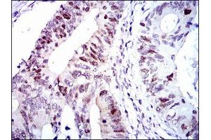 Immunohistochemistry (IHC) image for anti-Cyclin-Dependent Kinase 2 (CDK2) antibody (ABIN1845617) (CDK2 antibody)