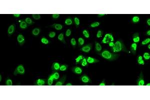 Immunofluorescence analysis of A-549 cells using FIP1L1 Polyclonal Antibody (FIP1L1 antibody)