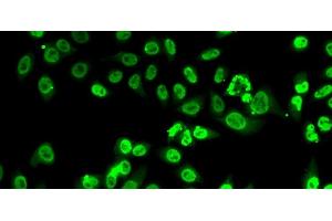 Immunofluorescence analysis of A-549 cells using FIP1L1 Polyclonal Antibody (FIP1L1 antibody)