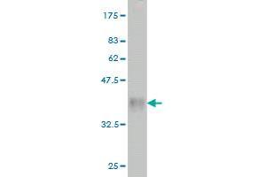 Western Blot detection against Immunogen (36. (RAB38 antibody  (AA 115-211))