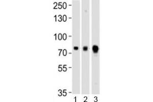 Western blot testing of Melk antibody at 1:1000 dilution and mouse 1) ovary, 2) spleen and 3) testis lysate; Predicted molecular weight ~ 73 kDa. (MELK antibody  (C-Term))