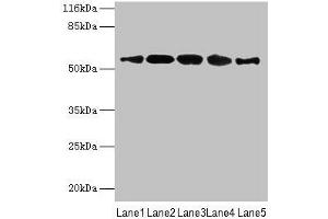 Western blot All lanes: VIPAS39 antibody at 12 μg/mL Lane 1: HepG2 whole cell lysate Lane 2: A431 whole cell lysate Lane 3: 293T whole cell lysate Lane 4: Mouse kidney tissue Lane 5: Hela whole cell lysate Secondary Goat polyclonal to rabbit IgG at 1/10000 dilution Predicted band size: 58, 52 kDa Observed band size: 58 kDa (VIPAR antibody  (AA 1-493))