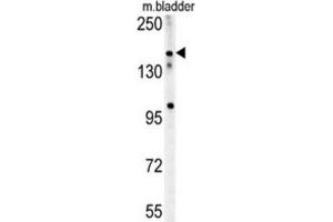 Western Blotting (WB) image for anti-Castor Zinc Finger 1 (CASZ1) antibody (ABIN2995579) (CASZ1 antibody)