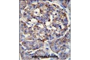 LRRC68 Antibody (N-term) (ABIN655144 and ABIN2844766) immunohistochemistry analysis in formalin fixed and paraffin embedded human pancreas tissue followed by peroxidase conjugation of the secondary antibody and DAB staining.