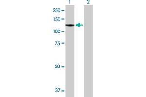 Western Blot analysis of GTF3C2 expression in transfected 293T cell line by GTF3C2 MaxPab polyclonal antibody. (GTF3C2 antibody  (AA 1-911))