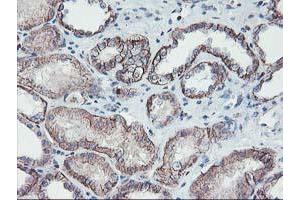 Image no. 6 for anti-Makorin Ring Finger Protein 1 (MKRN1) antibody (ABIN1499486)