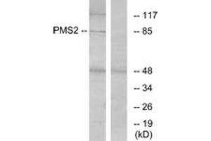 Western blot analysis of extracts from HeLa cells, using PMS2 Antibody.