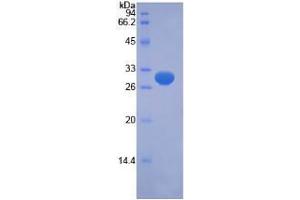 SDS-PAGE analysis of Human PINK1 Protein. (PINK1 Protein)