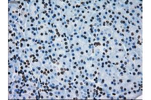 Immunohistochemical staining of paraffin-embedded lung tissue using anti-ERCC1 mouse monoclonal antibody.