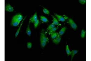 Immunofluorescence staining of Hela cells with ABIN7148543 at 1:133, counter-stained with DAPI. (CUTC antibody  (AA 1-64))