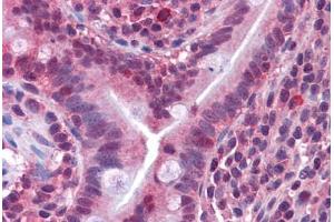 Human Small Intestine: Formalin-Fixed, Paraffin-Embedded (FFPE) (CACNG5 antibody  (AA 43-296))