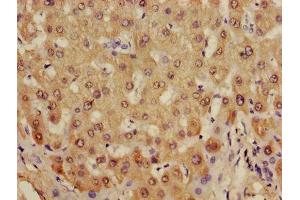 Immunohistochemistry (IHC) image for anti-Alcohol Dehydrogenase 1B (Class I), beta Polypeptide (ADH1B) (AA 2-375) antibody (ABIN7143645)