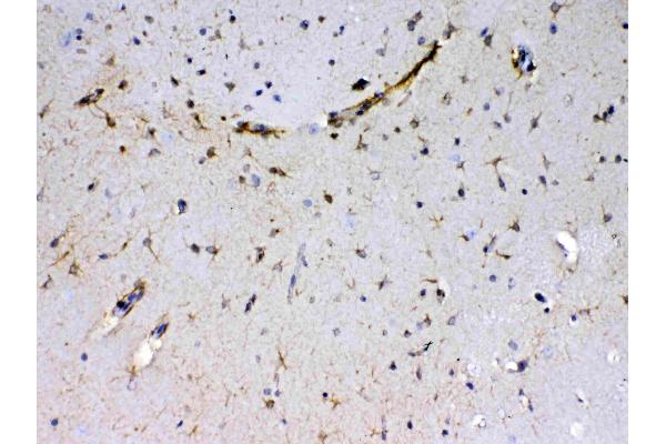 Sacsin antibody  (AA 3709-3909)