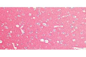 Immunohistochemistry of paraffin-embedded Human Brain using SNAP25 Polyclonal Antibody at dilution of 1:100. (SNAP25 antibody)