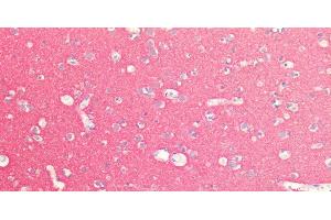 Immunohistochemistry of paraffin-embedded Human Brain using SNAP25 Polyclonal Antibody at dilution of 1:100. (SNAP25 antibody)