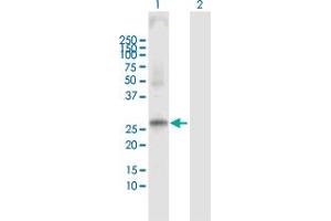 Western Blot analysis of PRSS1 expression in transfected 293T cell line by PRSS1 MaxPab polyclonal antibody.
