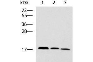 Western blot analysis of Mouse kidney tissue Rat brain tissue Mouse liver tissue lysates using CPLX3 Polyclonal Antibody at dilution of 1:950 (CPLX3 antibody)