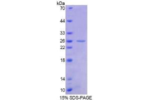 SDS-PAGE (SDS) image for Friend Leukemia Virus Integration 1 (FLI1) (AA 1-196) protein (His tag) (ABIN4989295)