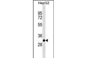 TARM1 Antibody (C-term) (ABIN1536920 and ABIN2850295) western blot analysis in HepG2 cell line lysates (35 μg/lane). (TARM1 antibody  (C-Term))