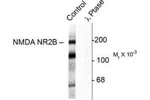 Image no. 1 for anti-Glutamate Receptor, Ionotropic, N-Methyl D-Aspartate 2B (GRIN2B) (pTyr1472) antibody (ABIN372687) (GRIN2B antibody  (pTyr1472))